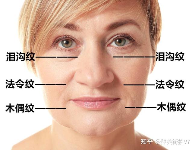 人为什么长皱纹