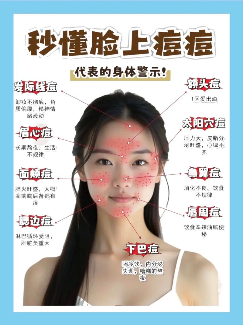 额头的痘痘是什么原因