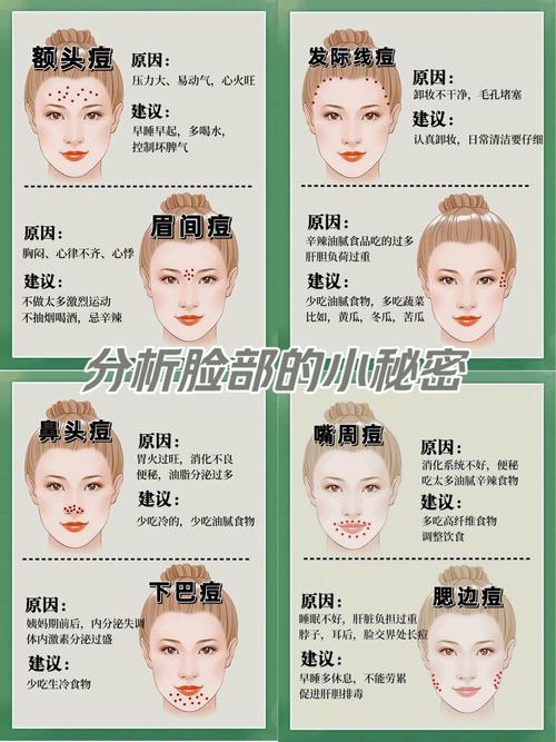 额头的痘痘是什么原因