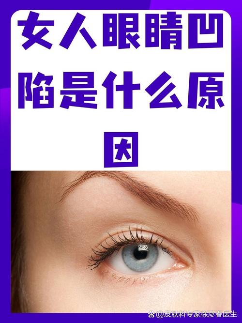 为什么会眼窝凹陷