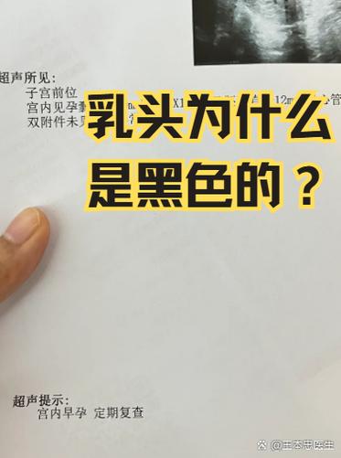 为什么乳头很黑