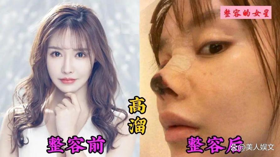 整容有什么风险