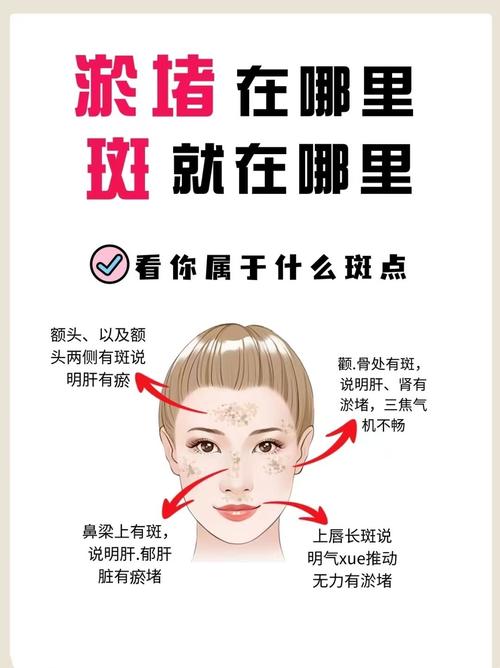 为什么会有黄褐斑