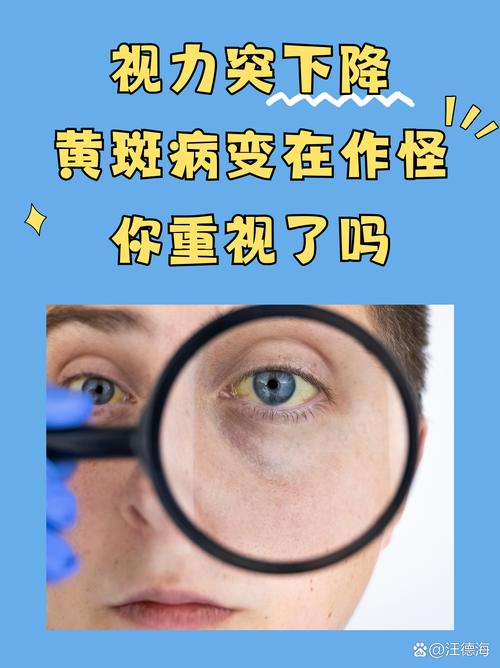 脸色发黄挂什么科