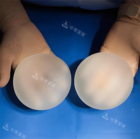 隆胸假体是什么