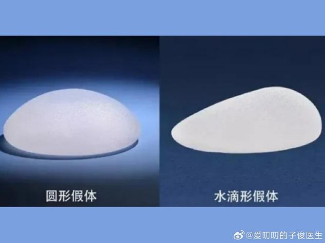 隆胸假体是什么