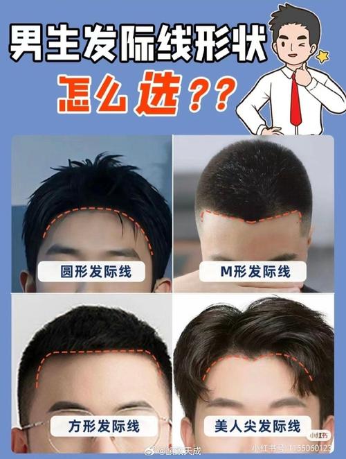 发际线高为什么