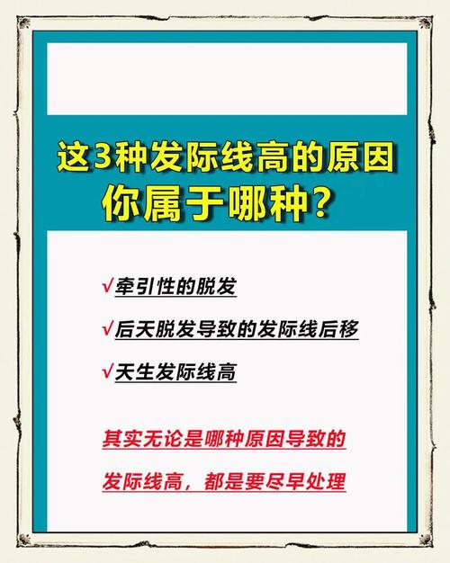 发际线高为什么