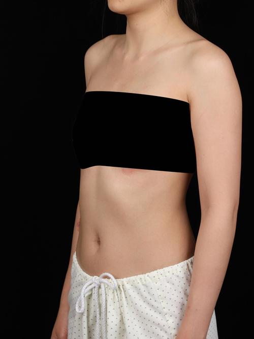 假体隆胸是什么