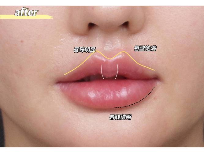 什么是唇线