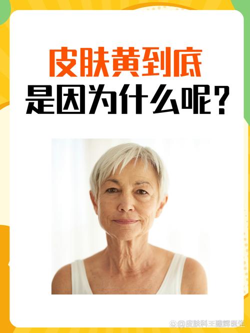 为什么皮肤越来越黄