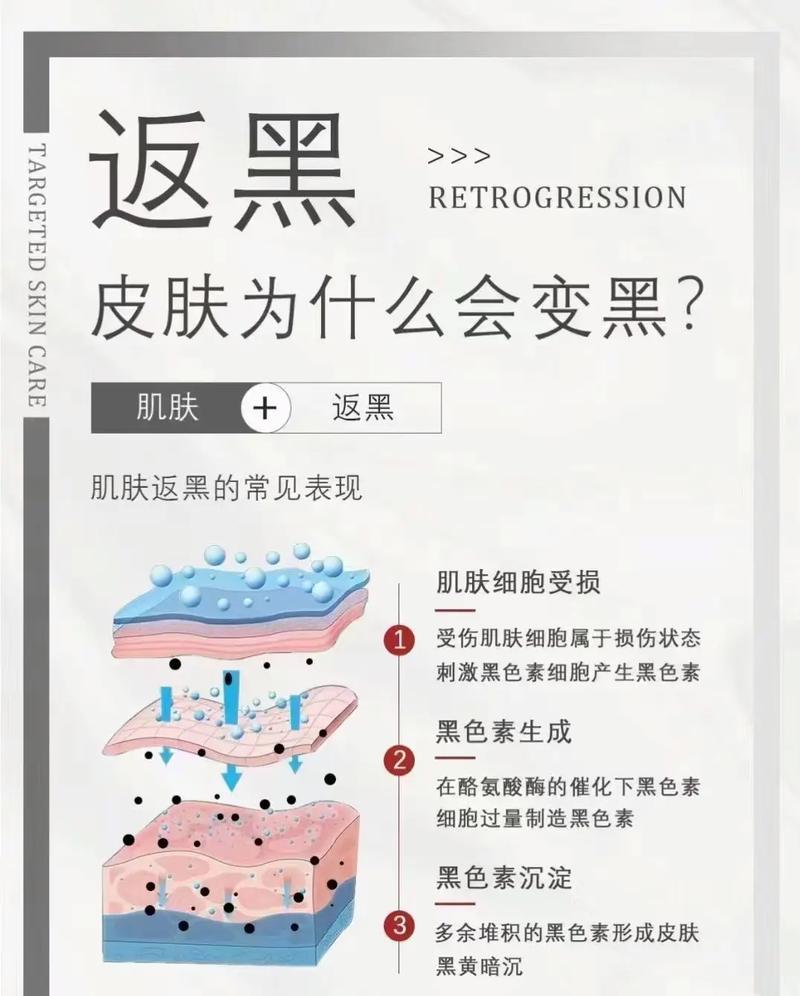 祛斑为什么会反黑