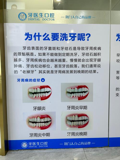 洗牙什么时候洗最好