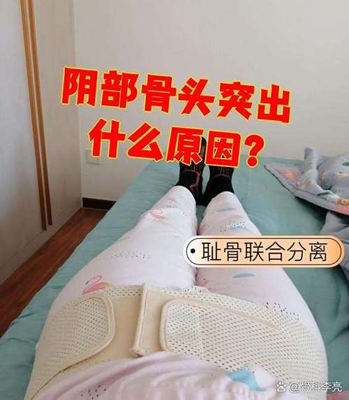 骨头大是什么原因