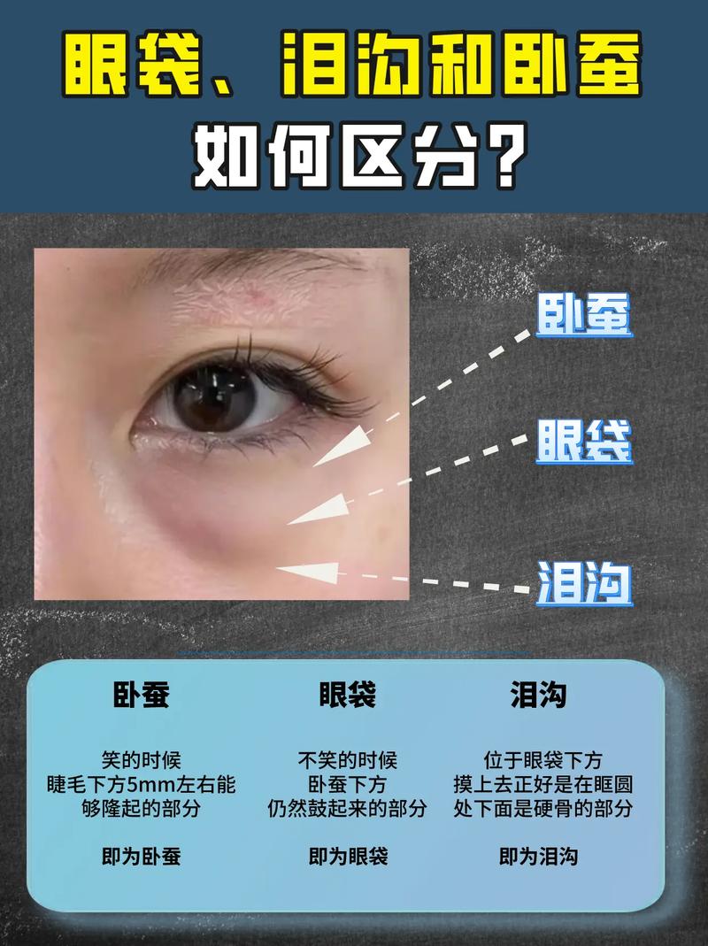 卧蚕有什么好处