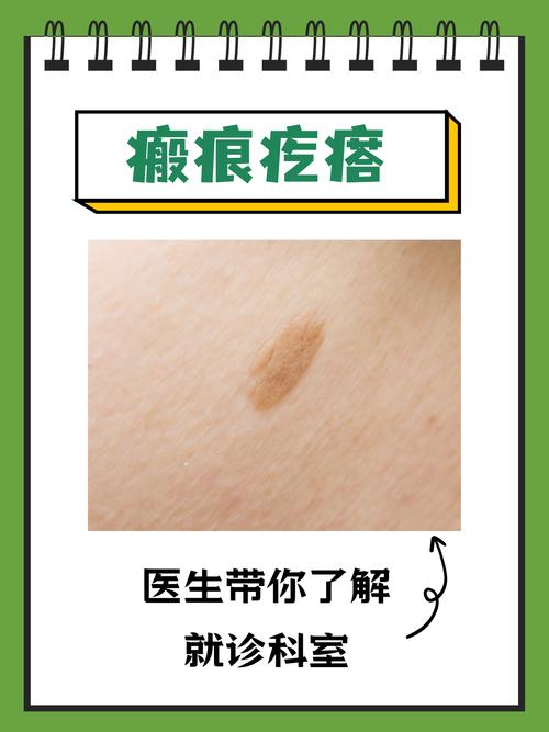 什么是疤痕疙瘩