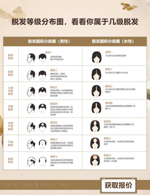 什么程度算脱发