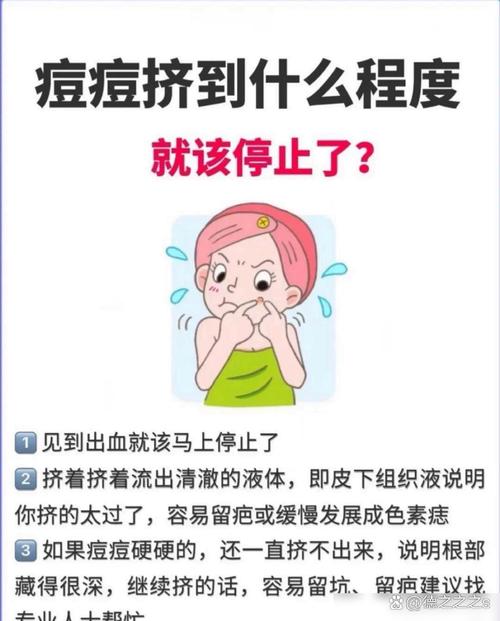 长暗疮是什么原因