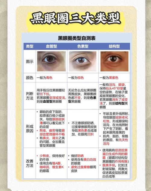 黑眼圈看什么科室