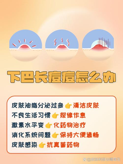 下颚痘痘是什么原因