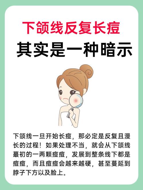 下颚痘痘是什么原因