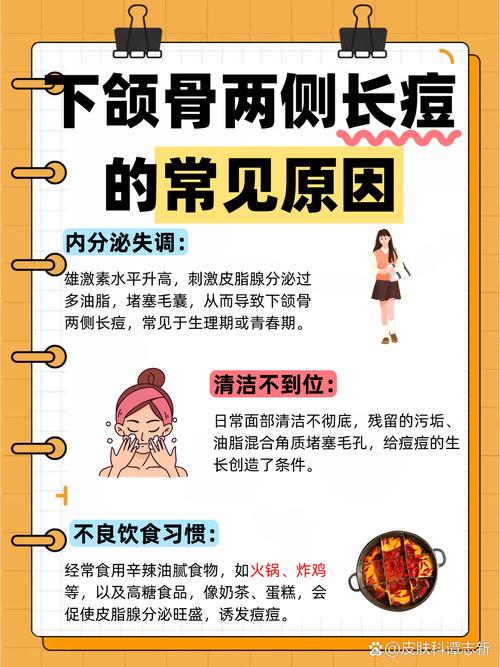 下颚痘痘是什么原因