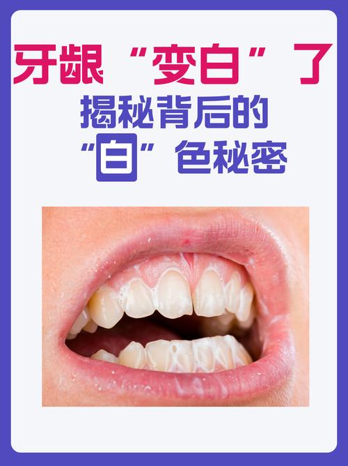 什么可以让牙齿变白