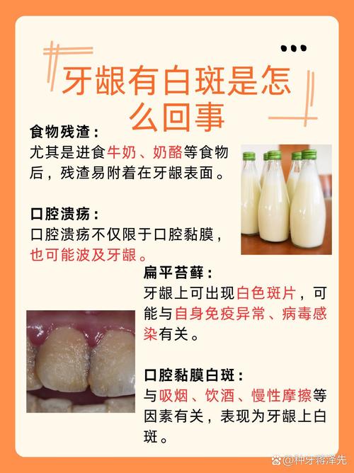 什么可以让牙齿变白