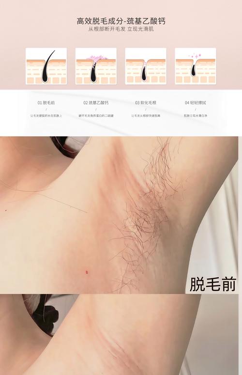 什么东西可以脱毛