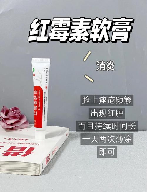 座疮用什么药膏