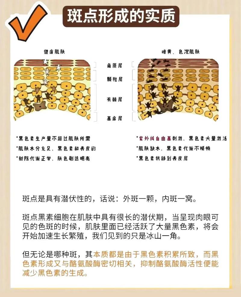 减肥后长斑什么原因