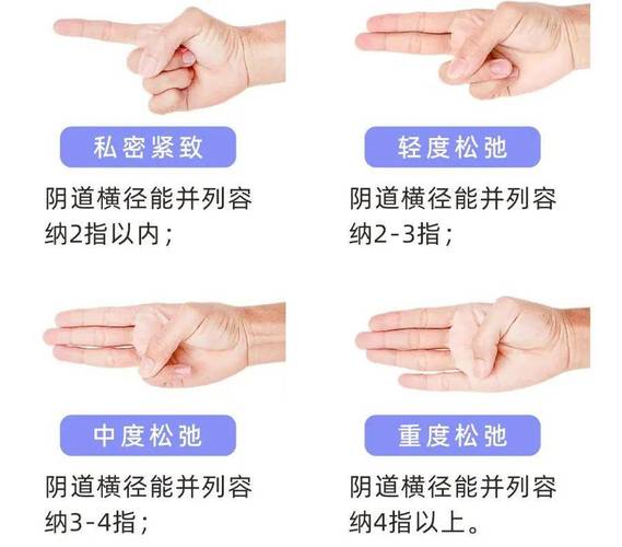 阴道松弛是什么