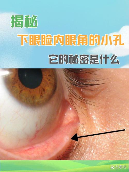 内眦是什么意思