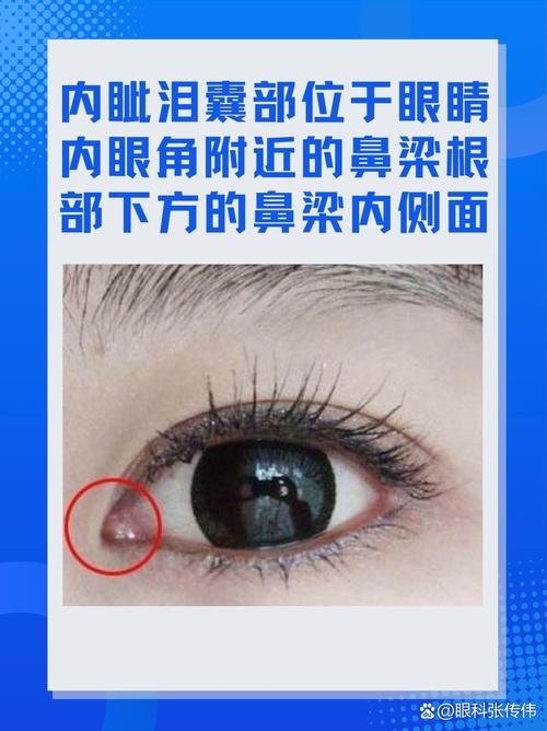 内眦是什么意思