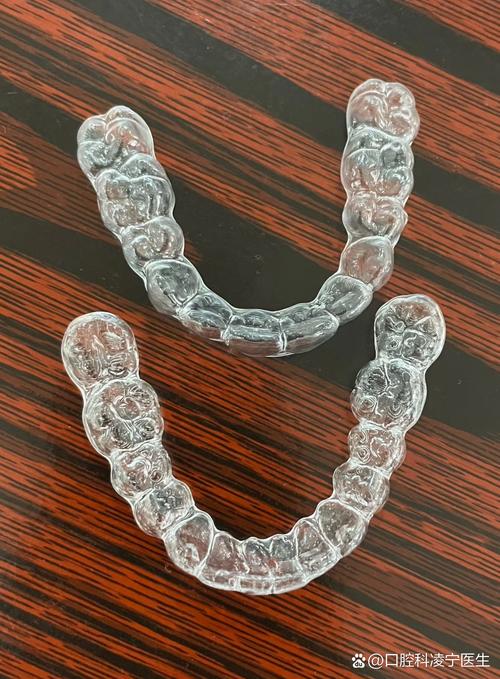 什么是隐形牙套