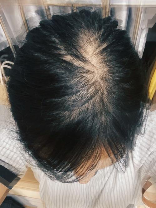 为什么头发又细又软