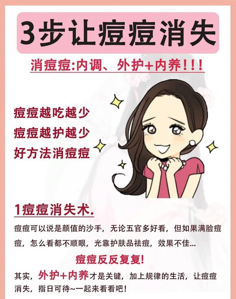 长痘需要注意什么