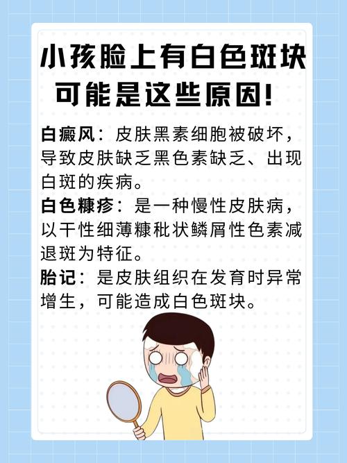 为什么脸上长白斑