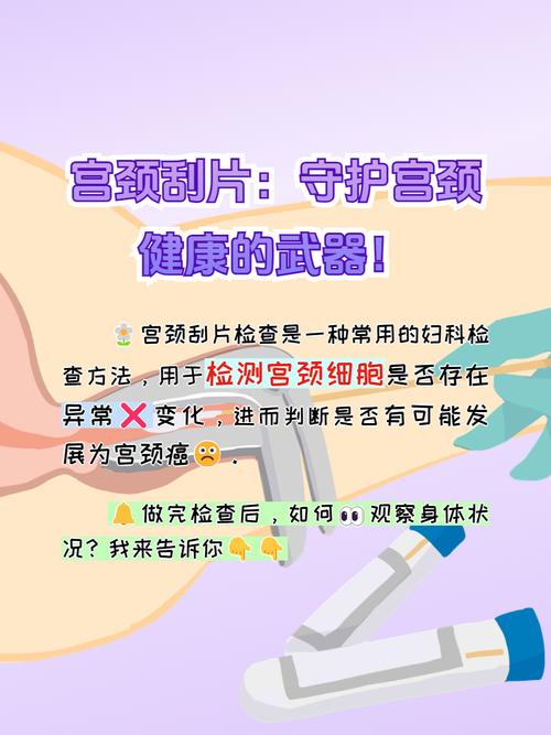 宫颈刮片查什么