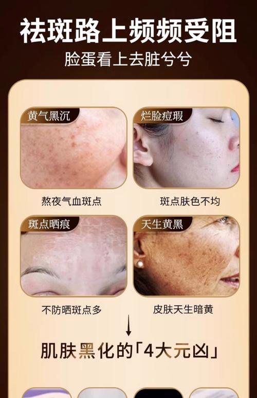 什么季节祛斑最好