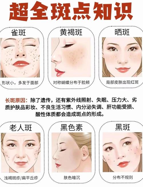 什么季节祛斑最好