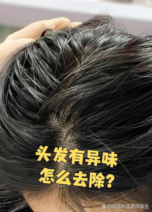 头发为什么会臭