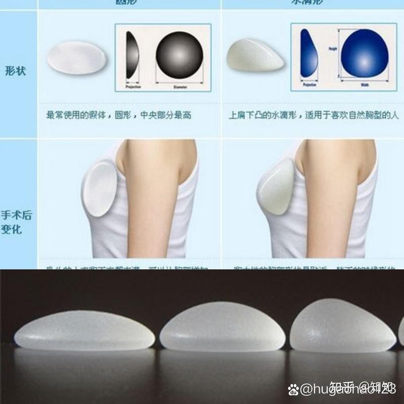 隆胸有什么危害