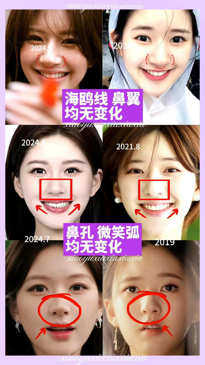 为什么说减肥是整容