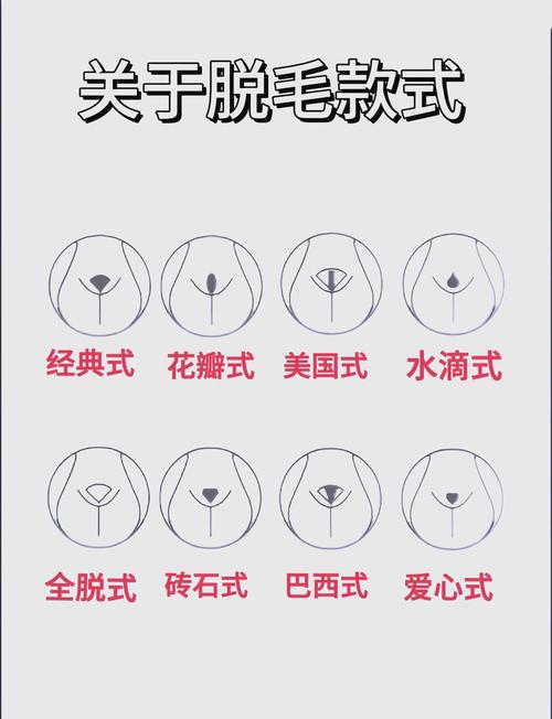 什么脱毛方法最好