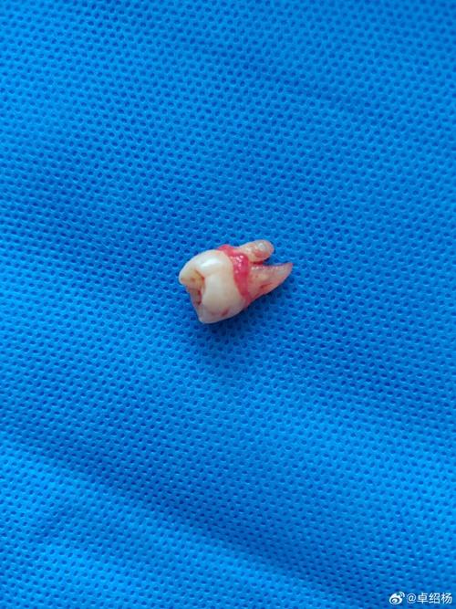 智齿图片是什么样的