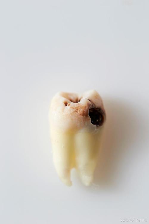 智齿图片是什么样的