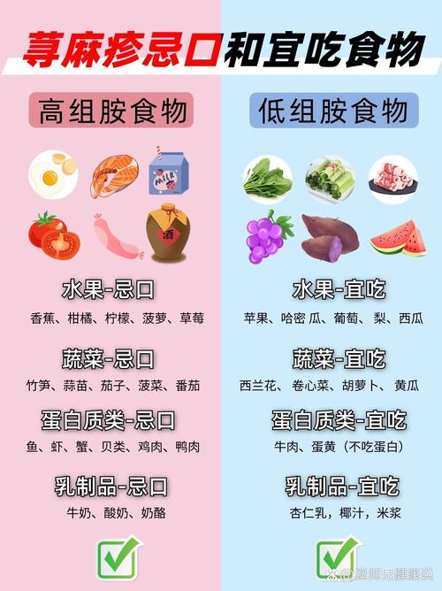 荨麻疹饮食注意什么