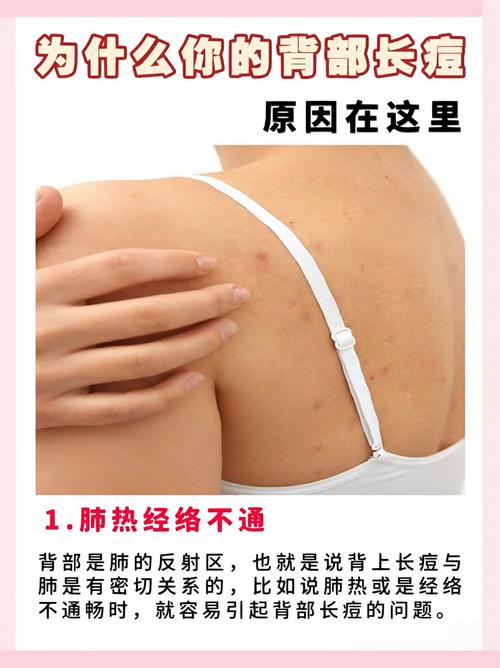后背起疙瘩什么原因