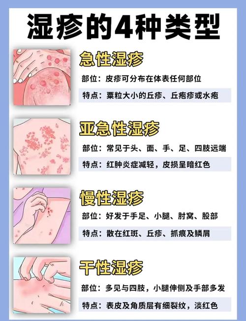 湿疹为什么会复发